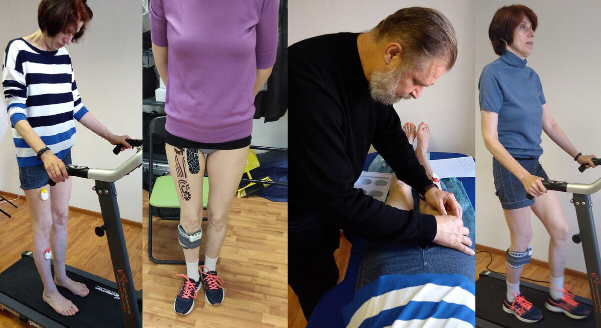 Функциональная электростимуляция (ФЭС)