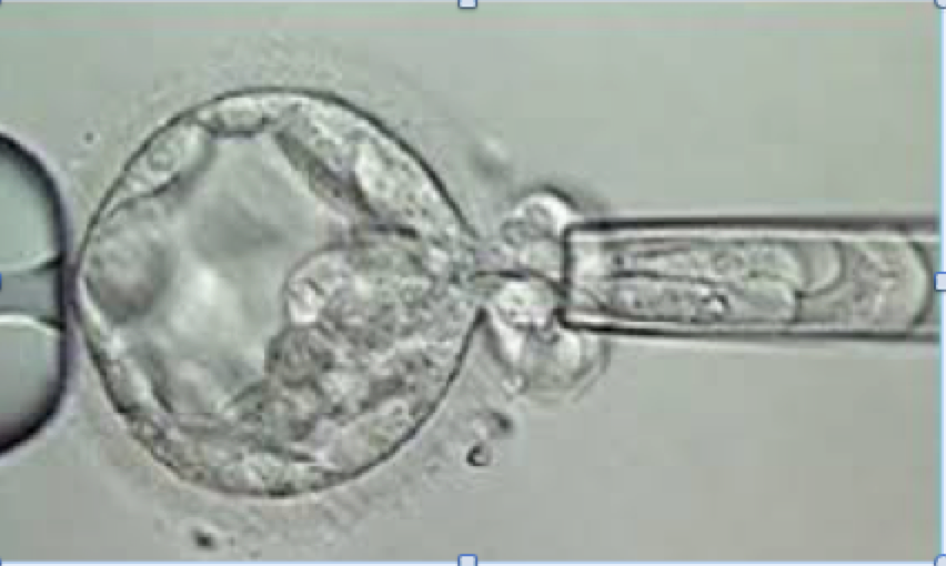 Биопсия трофэктодермы эмбриона. Биопсия бластоцисты. ПГД эмбриона. Преимплантационная генетическая диагностика эмбрионов.