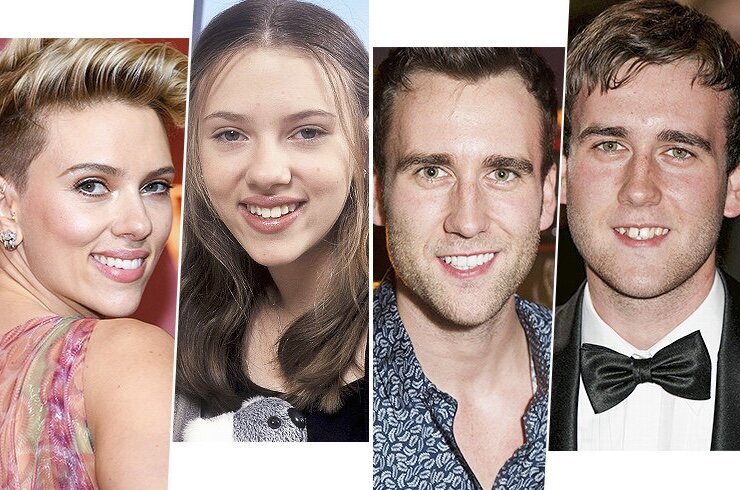 звёзды Голливуда после реставрации зубов