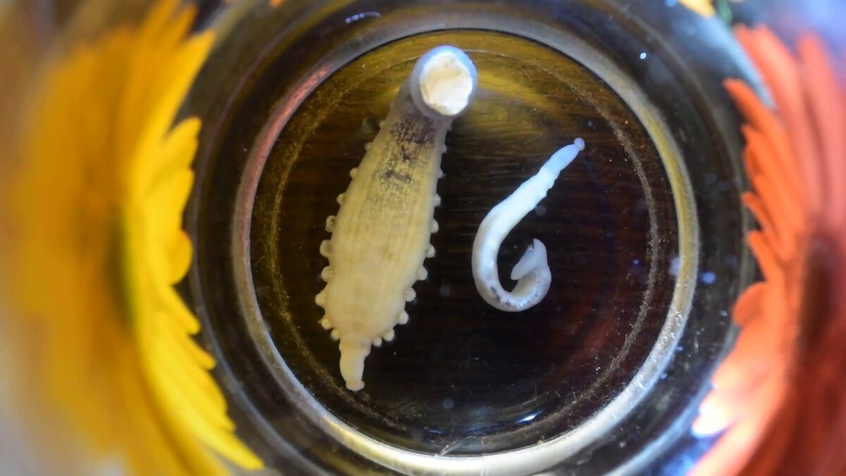 Trachelobdella sinensis