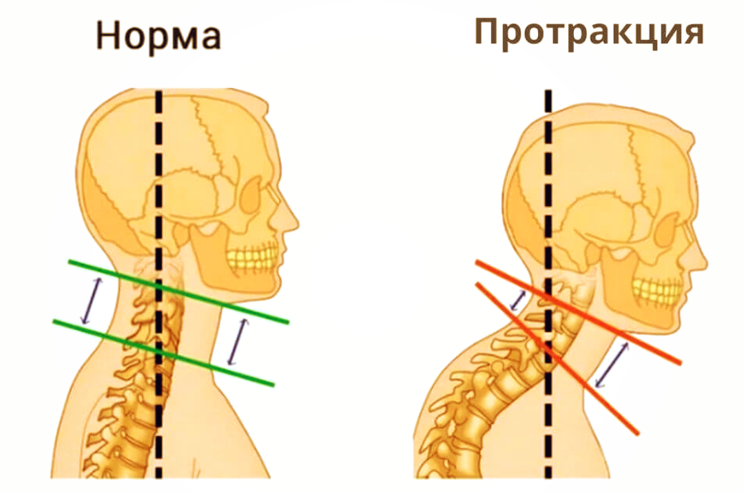 Стресс, неправильное положение за рабочим столом, слишком много времени смотрим в гаджеты, старение.