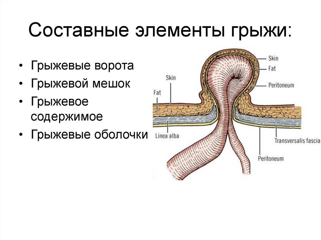 Почечная грыжа. Составные элементы грыжи. Строение наружной грыжи живота. Строение стенки грыжевого мешка. Составные части грыжи живота.