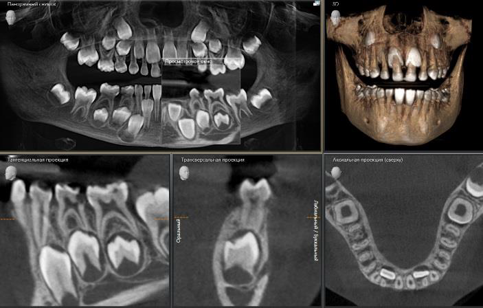 мрт энерго. мрт в больнице семашко. кт томограф. аппарат мрт 2022. Toshiba aquilion 128.