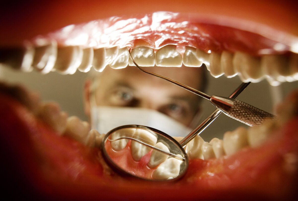 Люминиры в Москве: стоимость, достоинства, установка. Дентал Макс частная стом