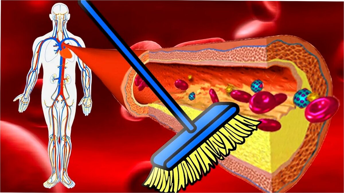 Как почистить сосуды в домашних условиях – Заря Кубани Новости Славянска-на-Кубани