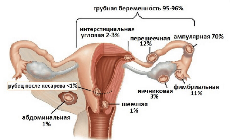 Отличительные симптомы в зависимости от локализации 