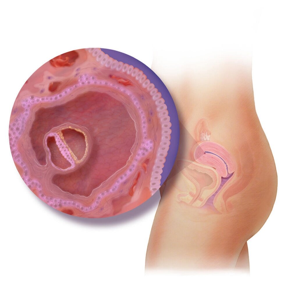 Источник фото: Яндекс Картинки