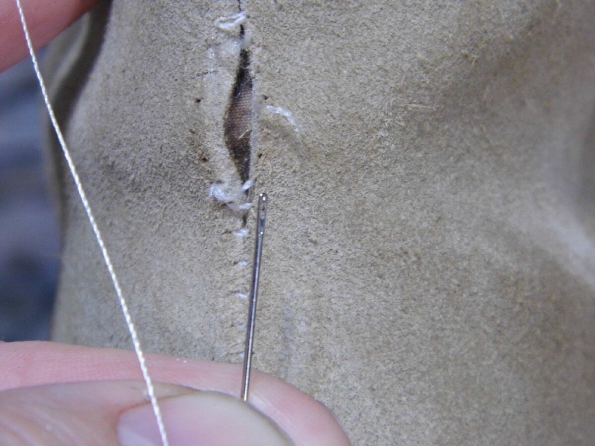 Сколько рассасываются нитки после операции