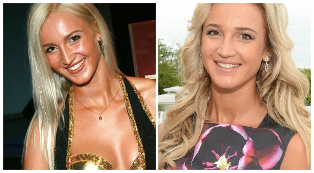 Бузова до пластики.  Блондинкой было намного лучше. 