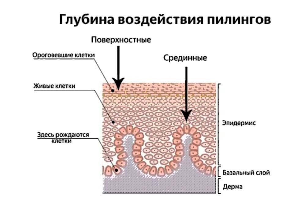 Красное лицо после пилинга