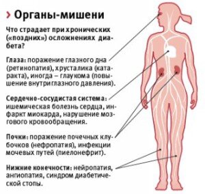 Диагностика скрытого диабета
