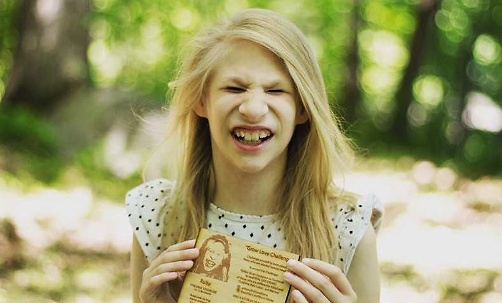 Девочка по имени Руби с синдромом Альстрёма.