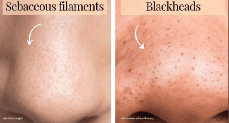 Фотография взята из zcosmetichealth.com