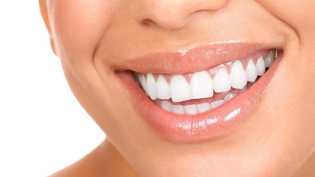 Как лучше отбелить зубы активированным углём. Фото: dentconsult