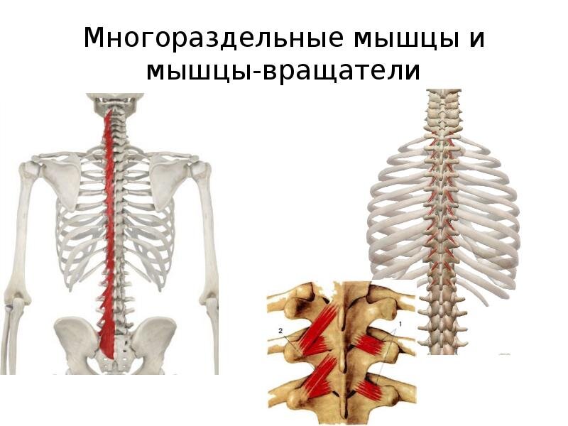 Фибромиалгия: причины, диагностика и лечение | Центр Дикуля