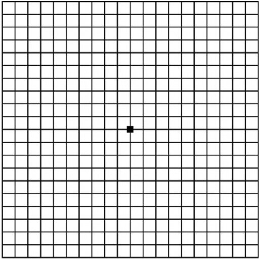 Решетка Амслера. Норма.