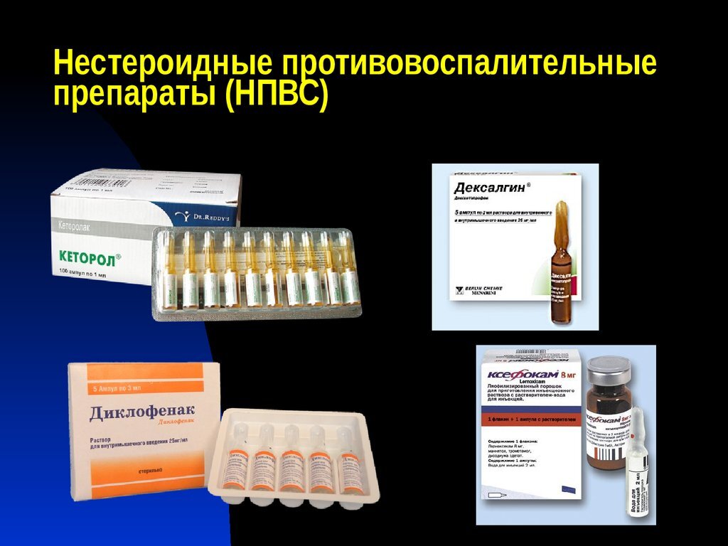 Обезболивающие при боли в позвоночнике. Нестероидные противовоспалительные препараты для боли в суставах. Нестероидные противовоспалительные препараты уколы. Препараты от остеохондроза уколы противовоспалительные препараты. НПВС внутримышечно препараты.