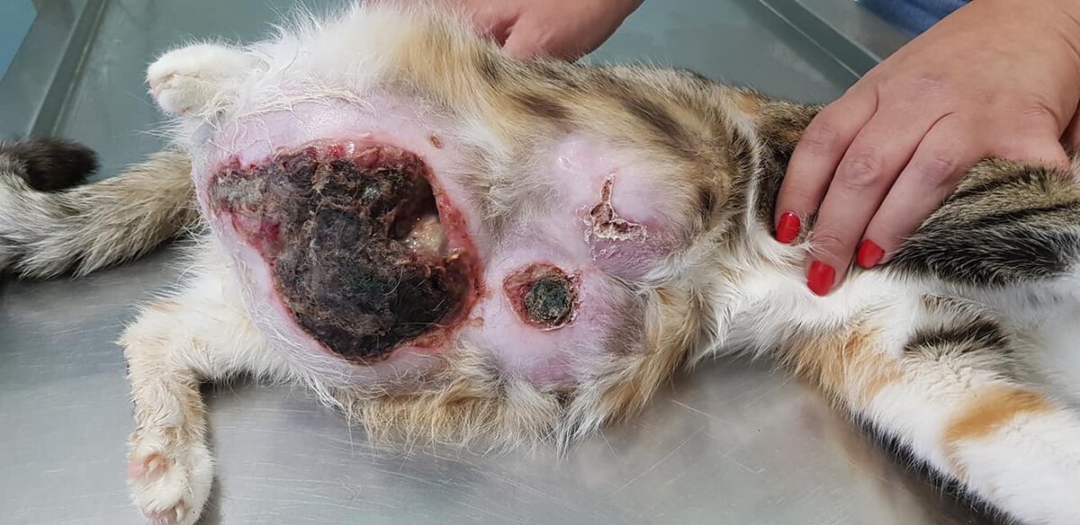 Запущенный фиброаденоматоз молочных желез на фоне "Ковинана"