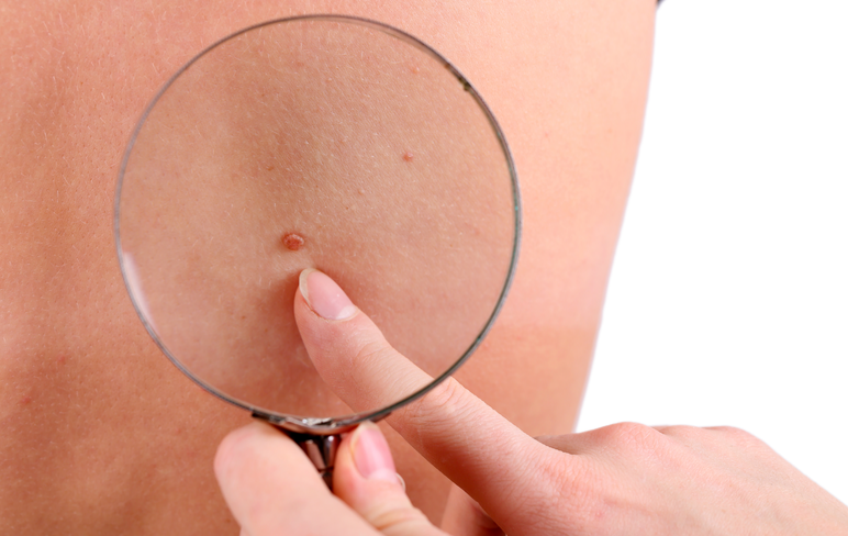 Наиболее тревожные изменения, которые не хотят заживать