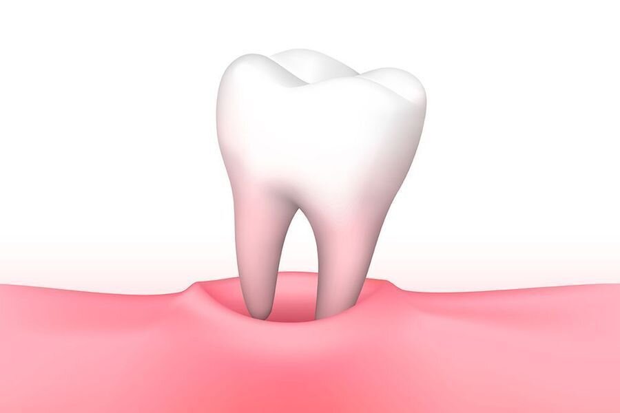 Сколько зубов можно удалять за один раз?