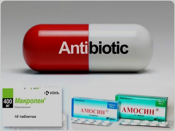 Гнойная ангина у ребенка: виды, симптомы и особенности лечения | Мир ...