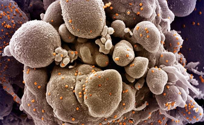 На фото: снимок вируса COVID-19, сделанный Национальным институтом аллергии и инфекционных заболеваний США (Фото: Zuma/TASS)