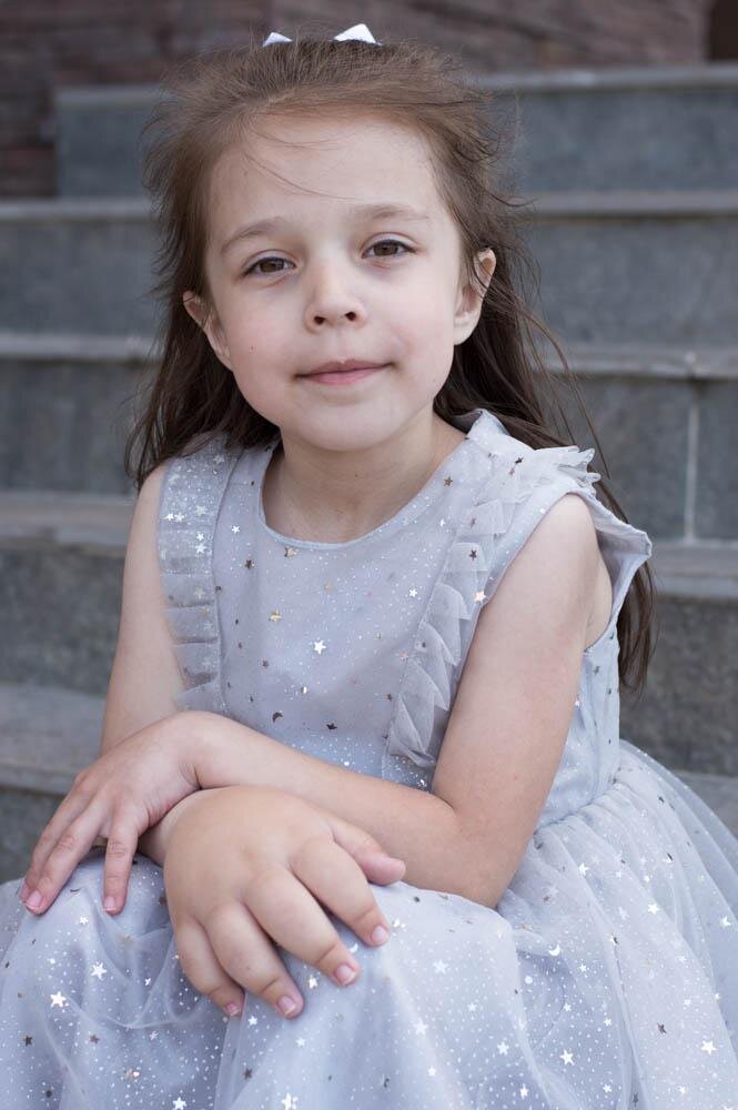 Из-за врождённой аномалии у Леры одна рука больше другой. Теперь она ...