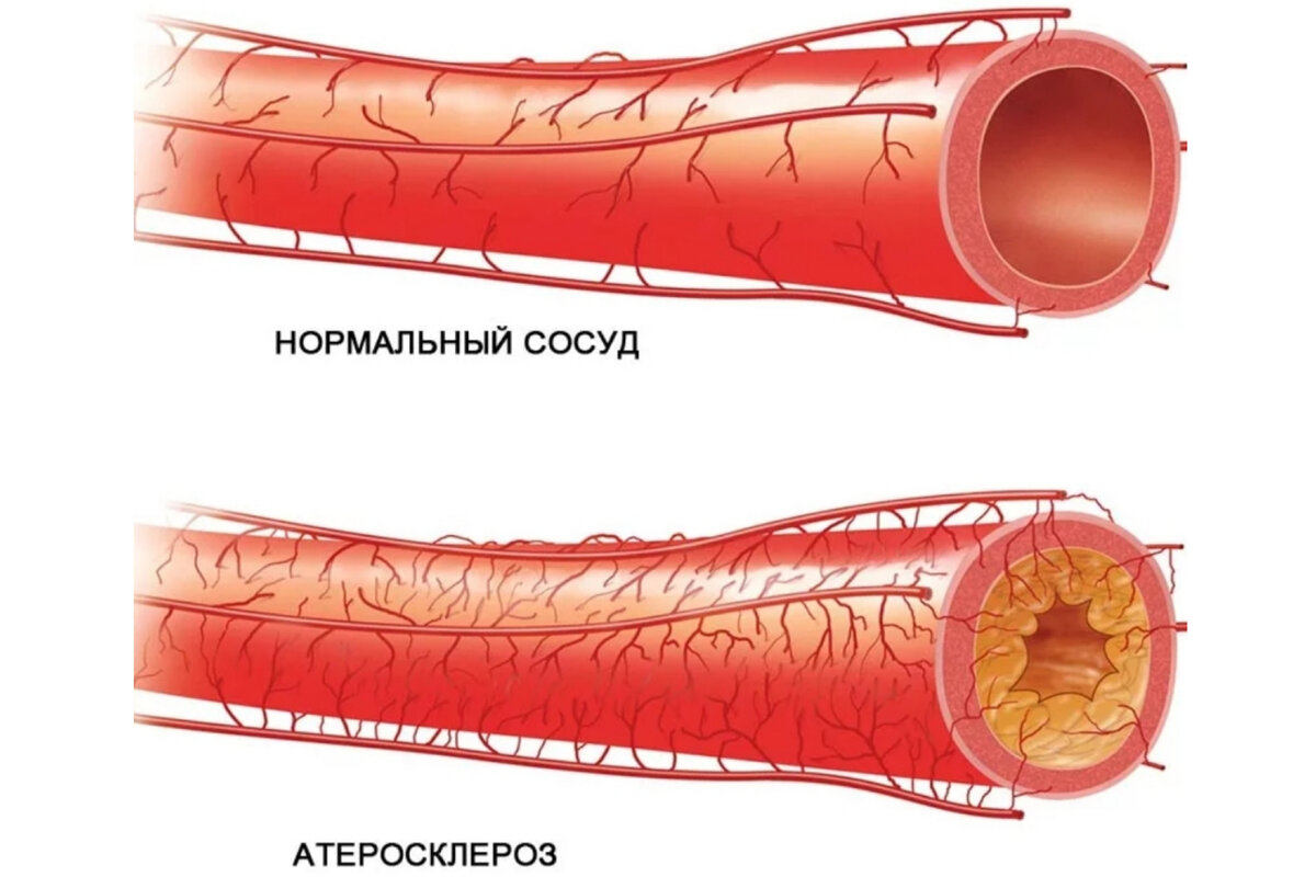 Именно поэтому руки и ноги прогреваются недостаточно