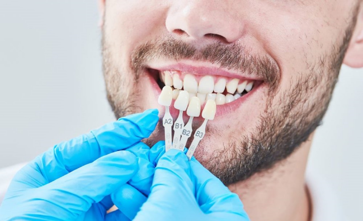 Красивые зубы. Красивые зубы стоматология. Красивые зубы мужские. Как называется протезист