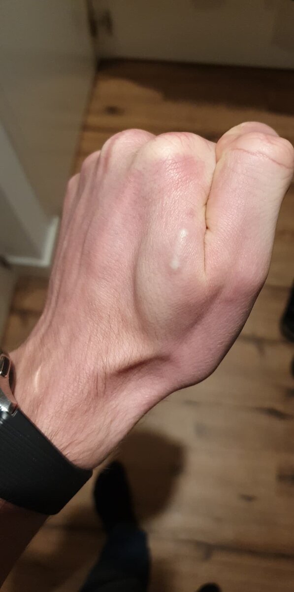 Чип, который вживил себя в руку Айсбрандт Хэутье