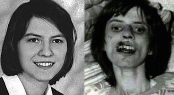 Да, на этих фотографиях изображена одна и та же девушка 