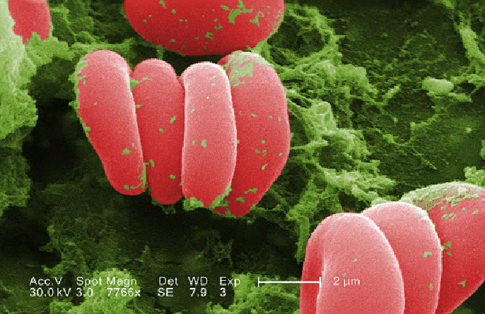 Микрофотография эритроцитов
