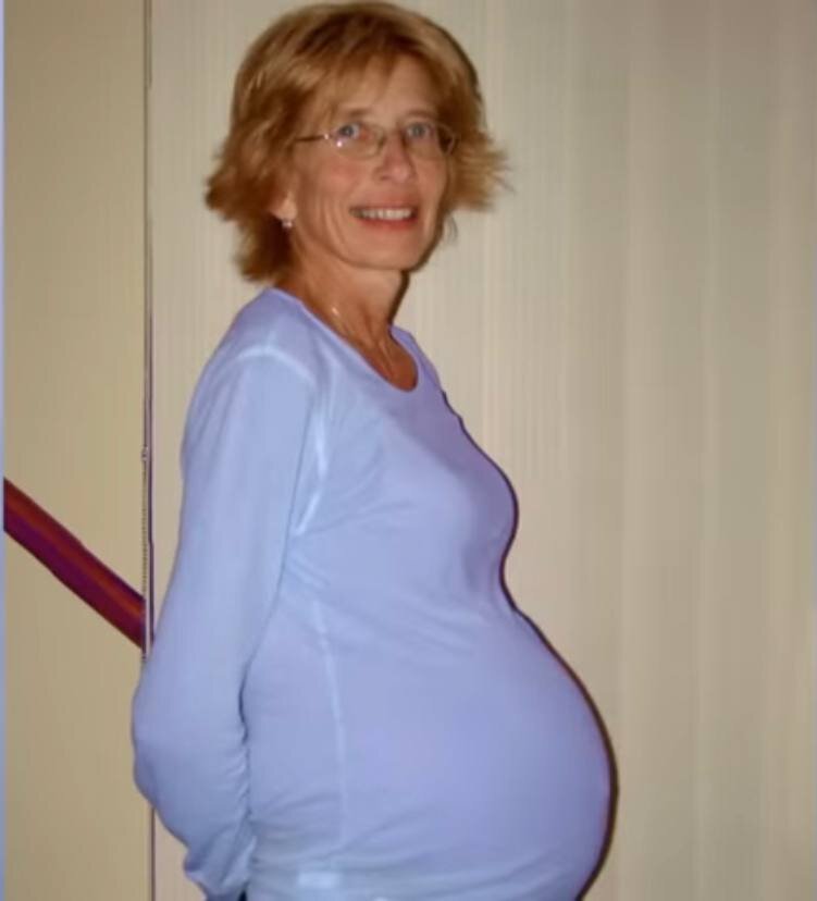 Удивительные случаи беременности. Часть 3 | Женя Миллер | Дзен