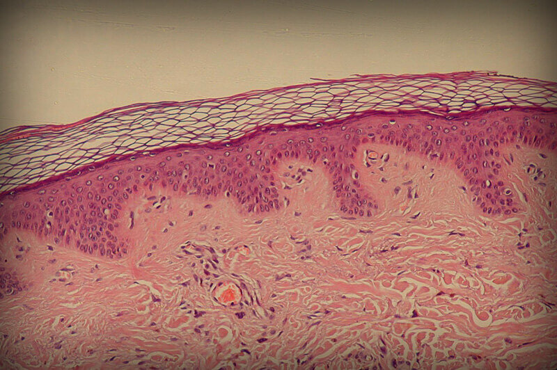 Источник фото - интернет. http://lechimprishi.ru/wp-content/uploads/2014/01/epidermis.jpg