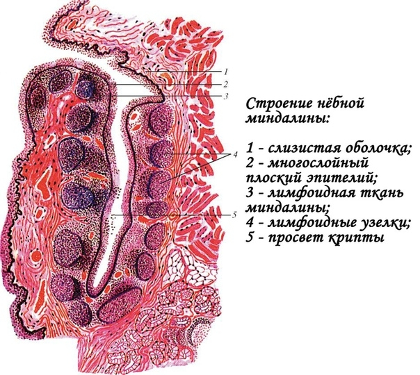 Как прочистить миндалины в домашних условиях — Статьи об онкологии