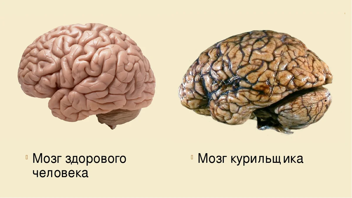 Головной мозг — Википедия