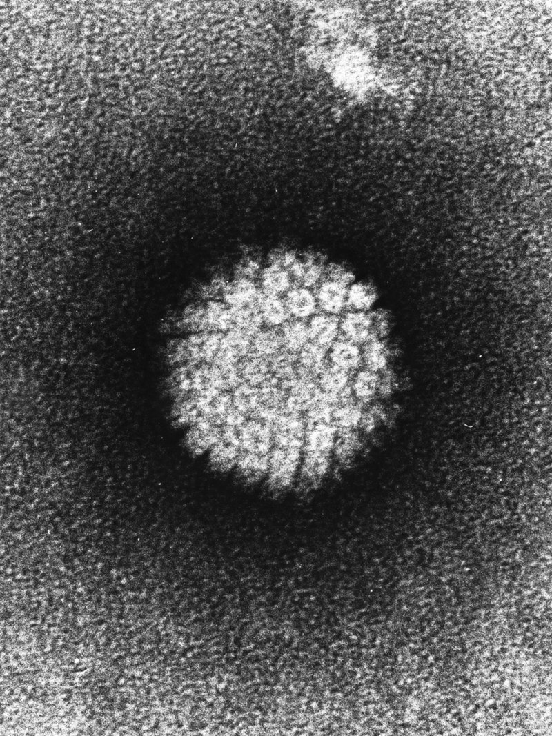 Инфекции #8. Вирус папилломы человека | Scientist Biologist | Дзен