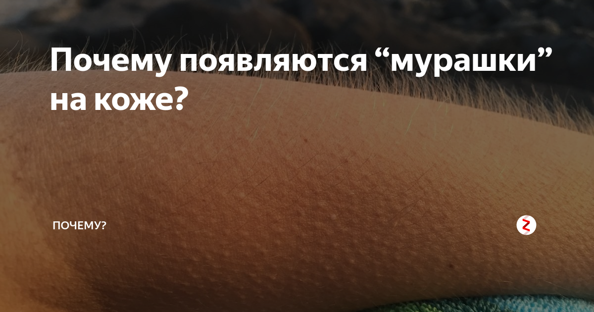 Мурашки по затылку. Мурашки на коже. Мурашки по коже бегут причины у женщин.