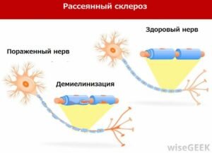 Питание — важная часть жизнедеятельности. Рождаясь, организм человека имеет большой запас питательных веществ, который со временем истощается. Современный ритм жизни часто приводит к беспорядочному употреблению вредной пищи. Зависимость от продуктов быстрого приготовления, фастфуда стала нормой. Однако, пренебрежение качеством продуктов чревато серьезными последствиями.