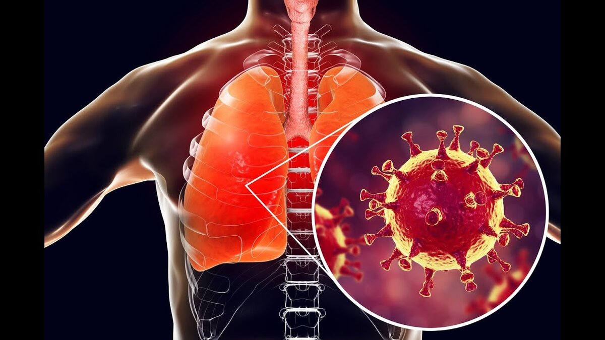Как происходит заражение?