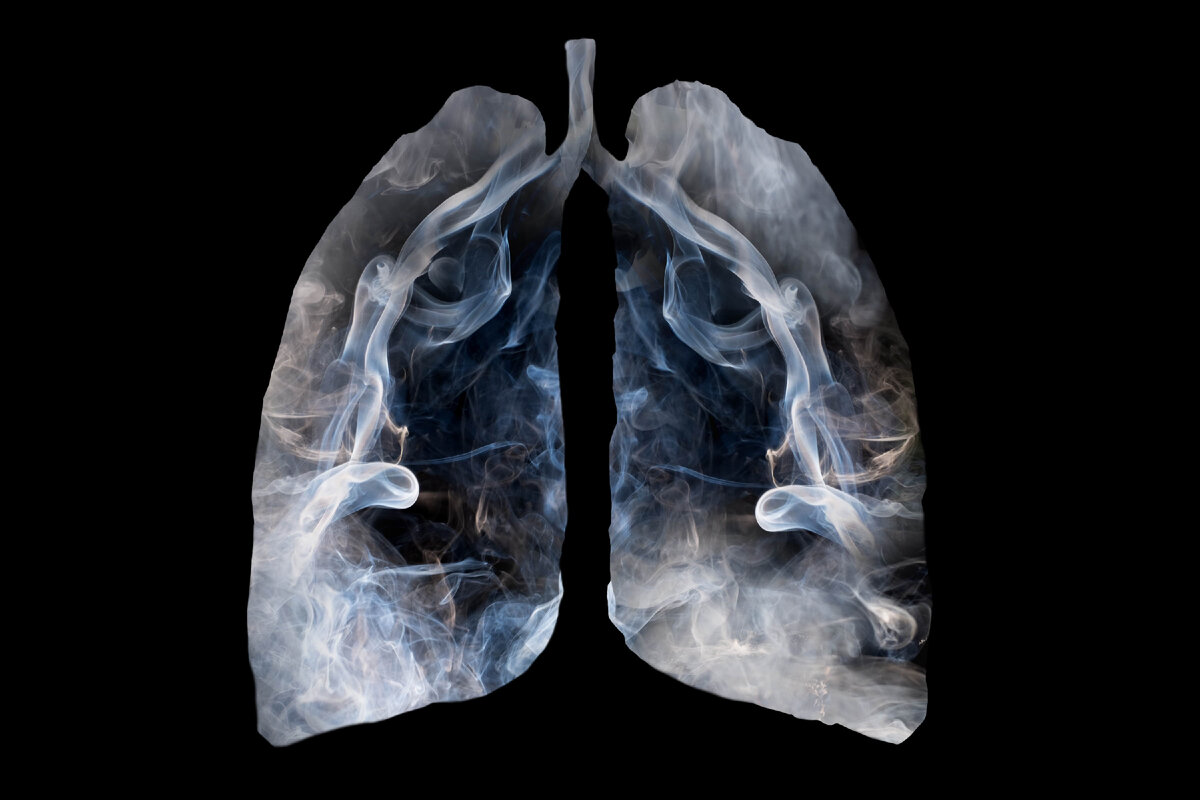 Illustration of a Toxic Smoke formation Shaped as the Human lung