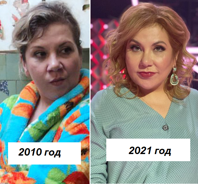 Федункив марина фото до и после пластики
