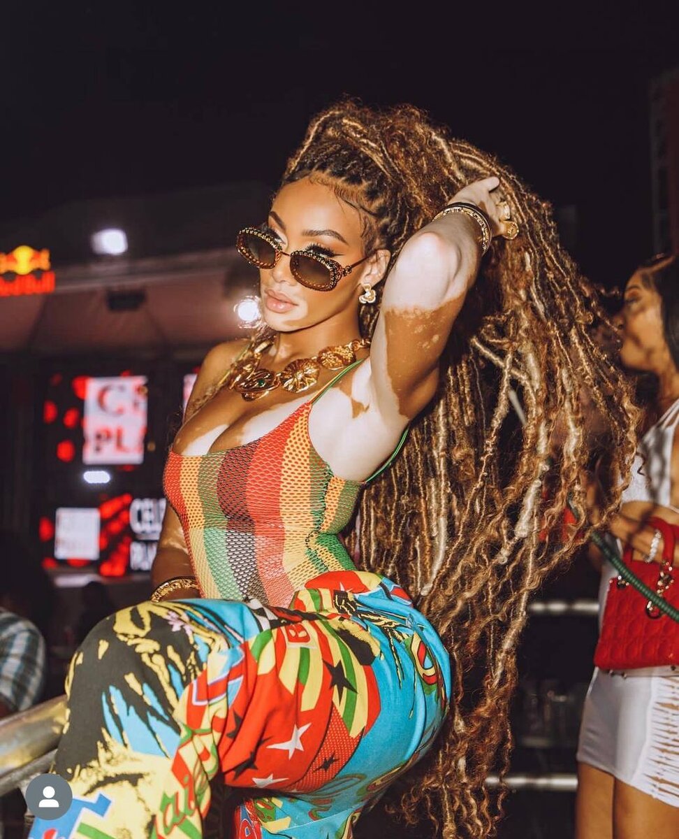    Винни ХарлоуСоцсети