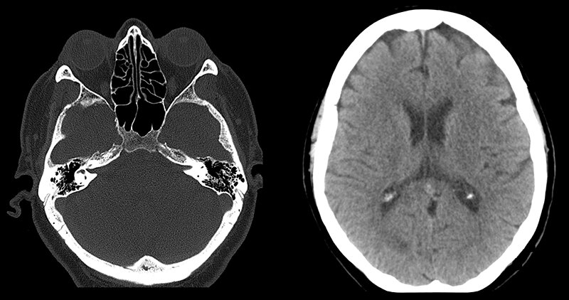 КТ головы. Источник: hospitalfts.ru