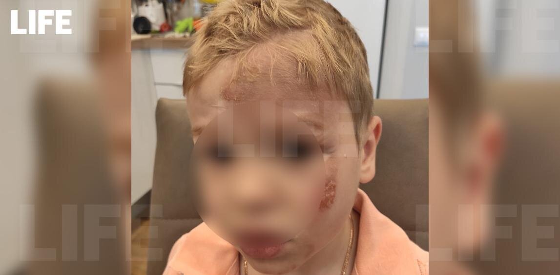 Фотографии ребенка из больницы ужасны!