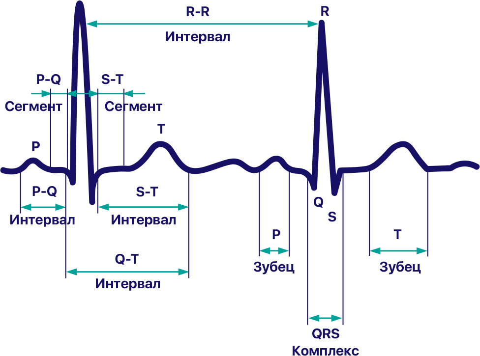 Что такое экг сердца. QRS норма ЭКГ. ЭКГ им v4-v6 зубец q. ЭКГ 2 отведение норма. Норма зубца QRS.
