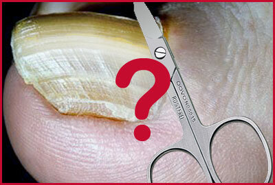 Щипчики и  ножницы не берут! 