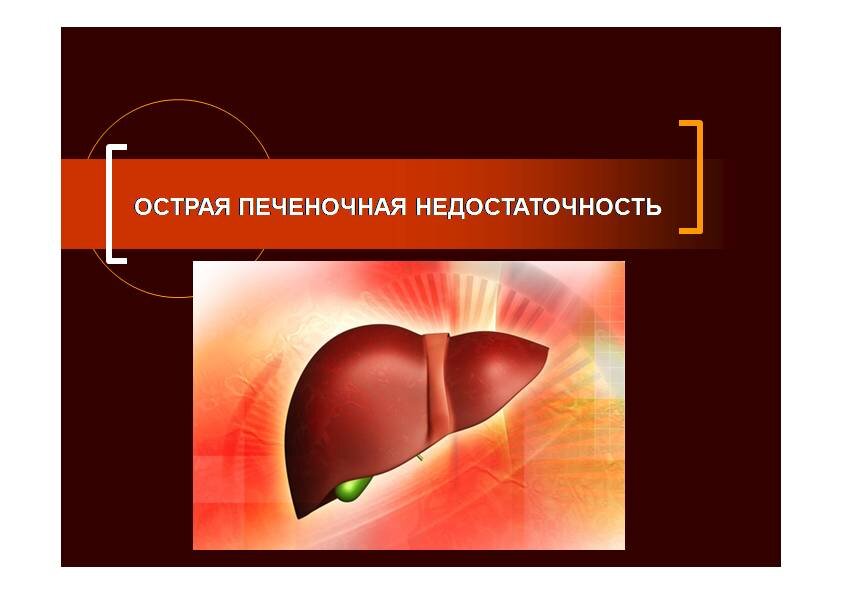 Острая недостаточность печени