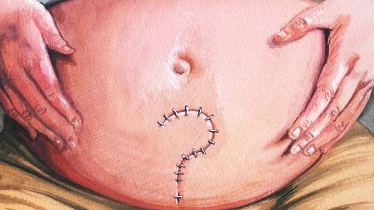 Источник фото Яндекс.Картинки