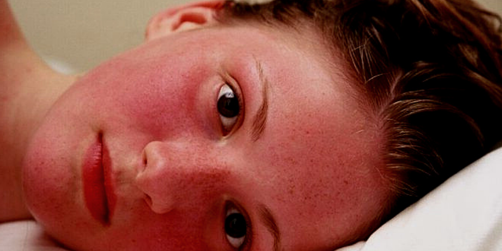 Девушка перед менструацией. Боль и жар.